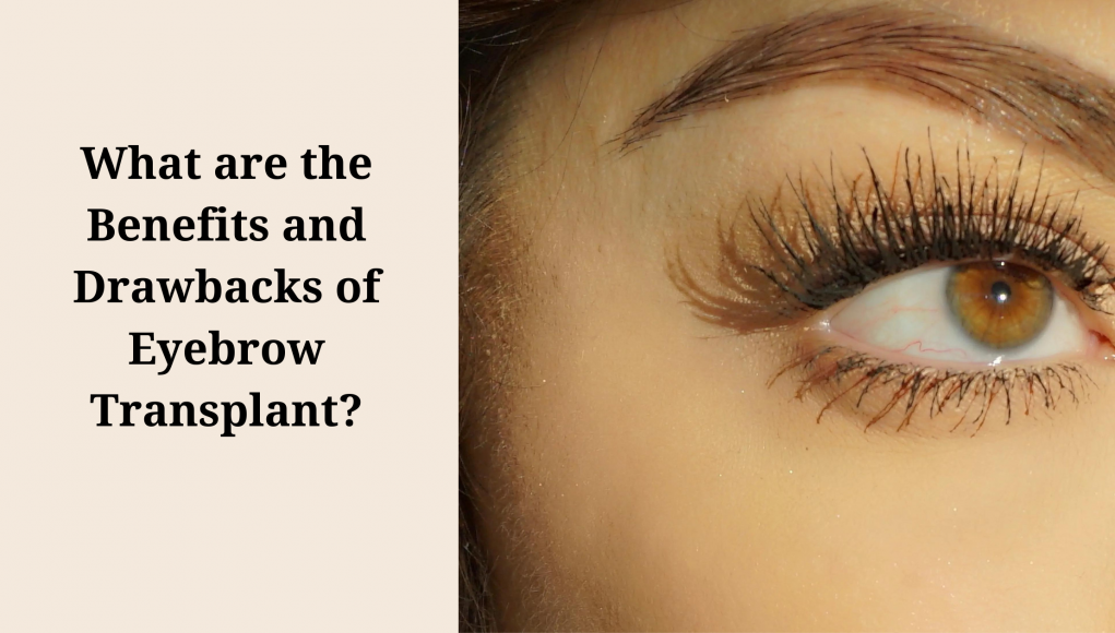 What are the Benefits and Drawbacks of Eyebrow Transplant?
