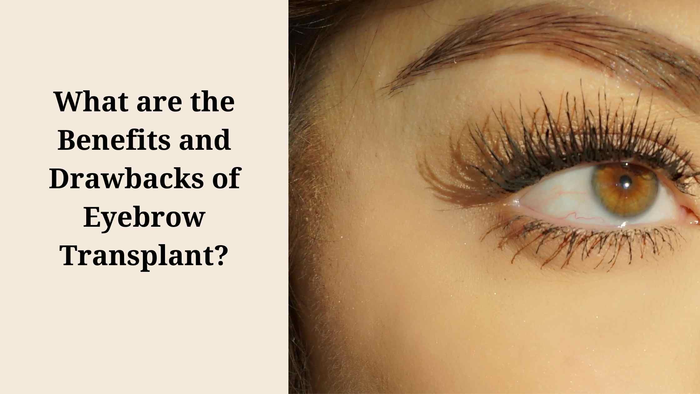 <strong>What are the Benefits and Drawbacks of Eyebrow Transplant?</strong>
