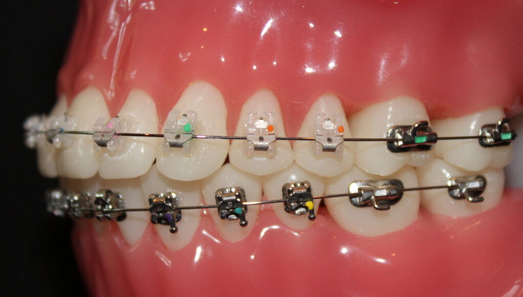 best orthodontist near me
